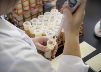 KMC plans to test quality of milk soon